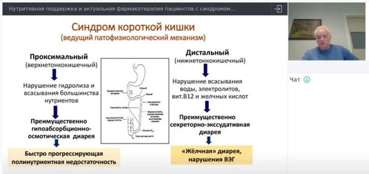Запись вебинара: синдром короткой кишки